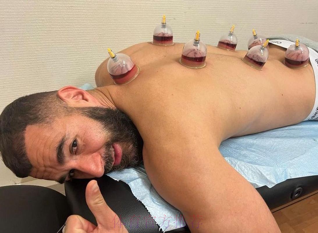 本泽马假期期间每天训练 今天接受了拔罐理疗 本泽马假期期间每天训练 今天接受了拔罐理疗